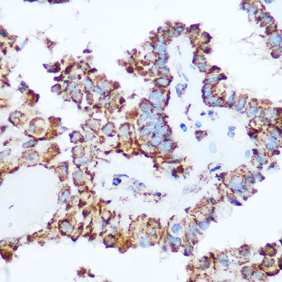 PDHA1 Antibody in Immunohistochemistry (Paraffin) (IHC (P))