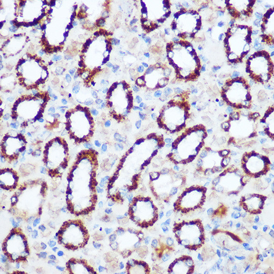 PDHA1 Antibody in Immunohistochemistry (Paraffin) (IHC (P))