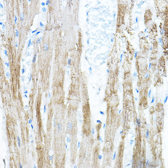 PDK4 Antibody in Immunohistochemistry (Paraffin) (IHC (P))