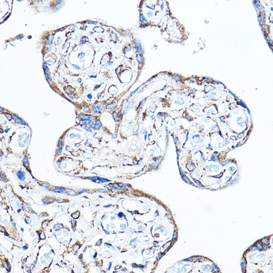 PDK4 Antibody in Immunohistochemistry (Paraffin) (IHC (P))