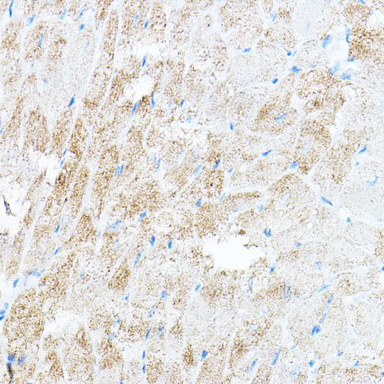 PDK4 Antibody in Immunohistochemistry (Paraffin) (IHC (P))