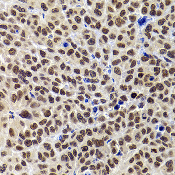 PHIP Antibody in Immunohistochemistry (Paraffin) (IHC (P))