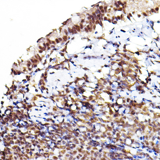 Phospho-AKT1/AKT2/AKT3 (Ser473) Antibody in Immunohistochemistry (Paraffin) (IHC (P))