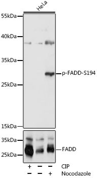 Phospho-FADD (Ser194) Antibody in Western Blot (WB)