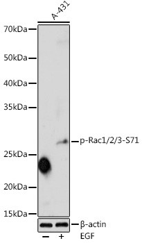 Phospho-RAC1 (Ser71) Antibody in Western Blot (WB)