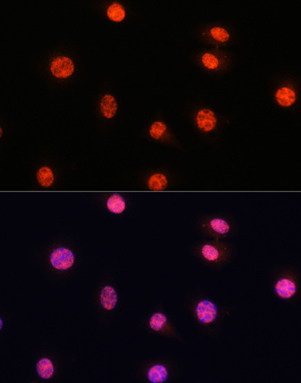 Phospho-SMAD2/SMAD3 (Ser465, Ser467, Ser423, Ser425) Antibody in Immunocytochemistry (ICC/IF)