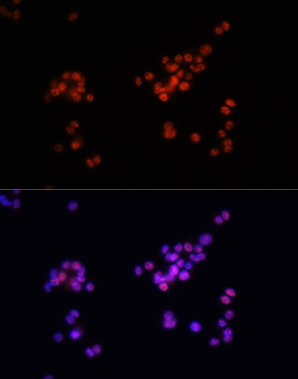 Phospho-SMAD2/SMAD3 (Ser465, Ser467, Ser423, Ser425) Antibody in Immunocytochemistry (ICC/IF)