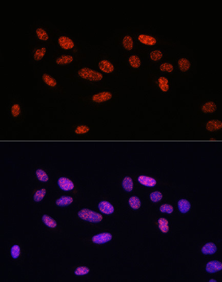 Phospho-SMAD2/SMAD3 (Ser465, Ser467, Ser423, Ser425) Antibody in Immunocytochemistry (ICC/IF)