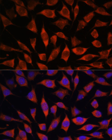 POGLUT1 Antibody in Immunocytochemistry (ICC/IF)