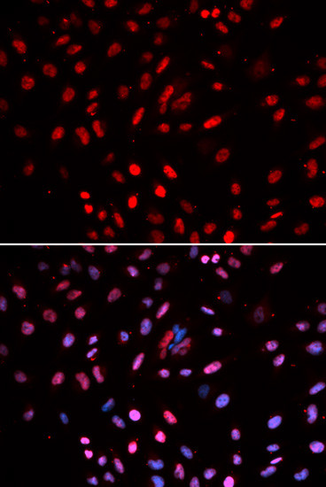 POLD1 Antibody in Immunocytochemistry (ICC/IF)