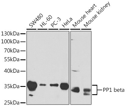 PPP1CB Antibody in Western Blot (WB)
