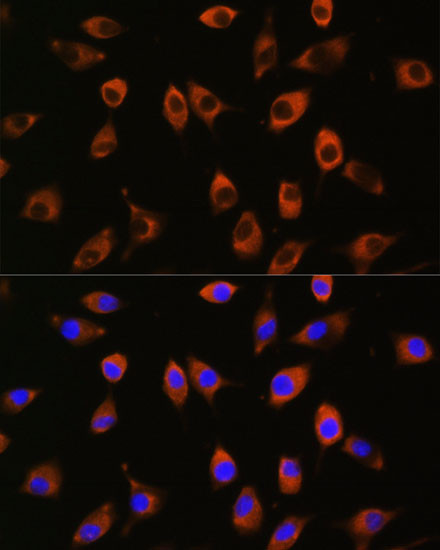 PPP1R9B Antibody in Immunocytochemistry (ICC/IF)