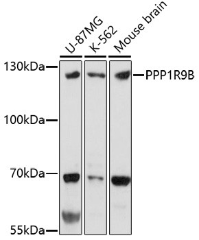 PPP1R9B Antibody in Western Blot (WB)