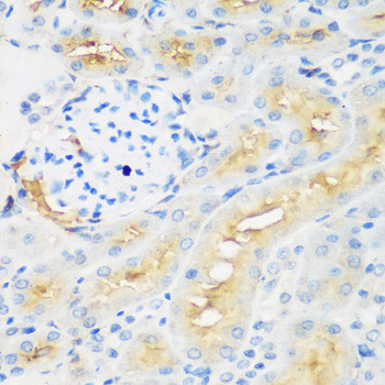 PROCR Antibody in Immunohistochemistry (Paraffin) (IHC (P))