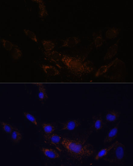 PSMB7 Antibody in Immunocytochemistry (ICC/IF)