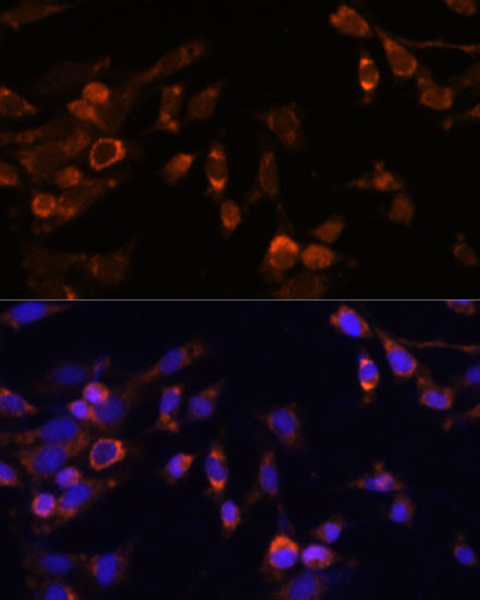 PSMB7 Antibody in Immunocytochemistry (ICC/IF)