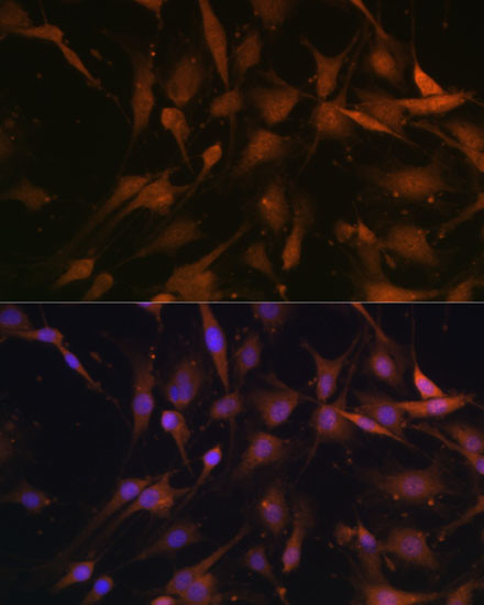 PSMD13 Antibody in Immunocytochemistry (ICC/IF)