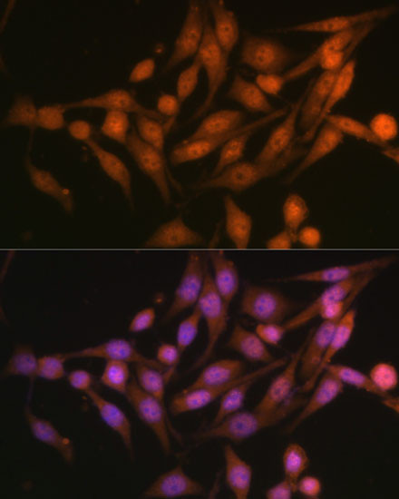 PSMD13 Antibody in Immunocytochemistry (ICC/IF)