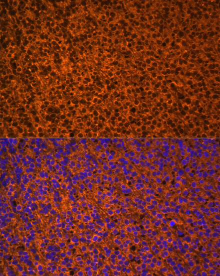 PTCH Antibody in Immunocytochemistry (ICC/IF)