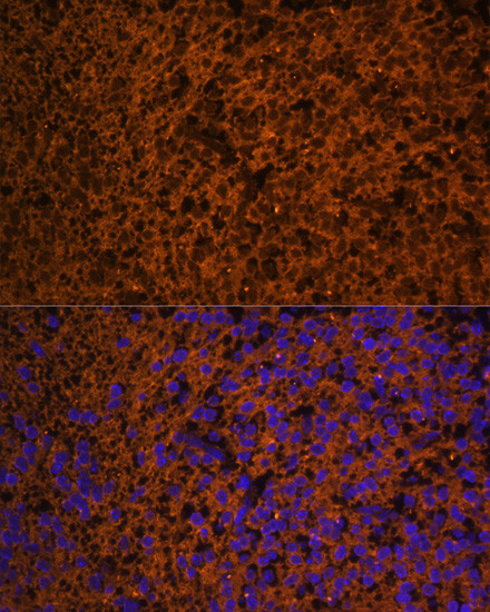 PTCH Antibody in Immunocytochemistry (ICC/IF)