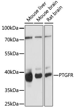 PTGFR Antibody in Western Blot (WB)