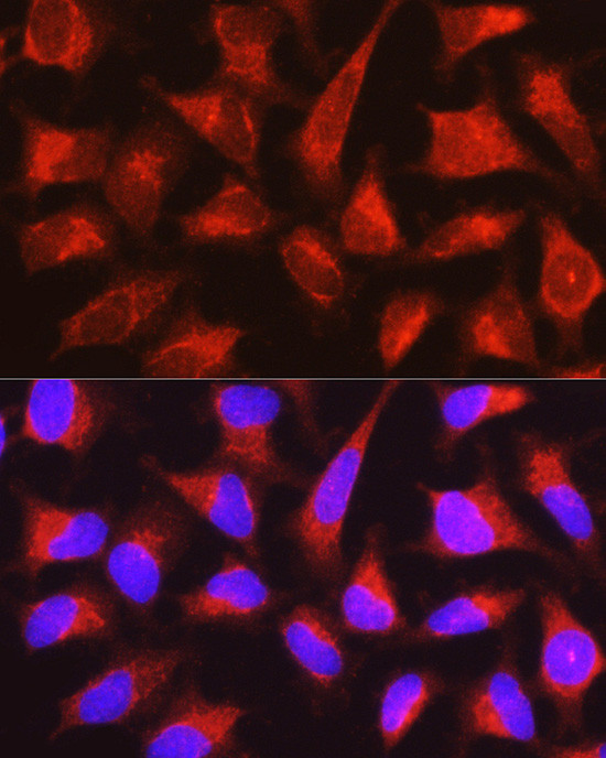 PYGL Antibody in Immunocytochemistry (ICC/IF)