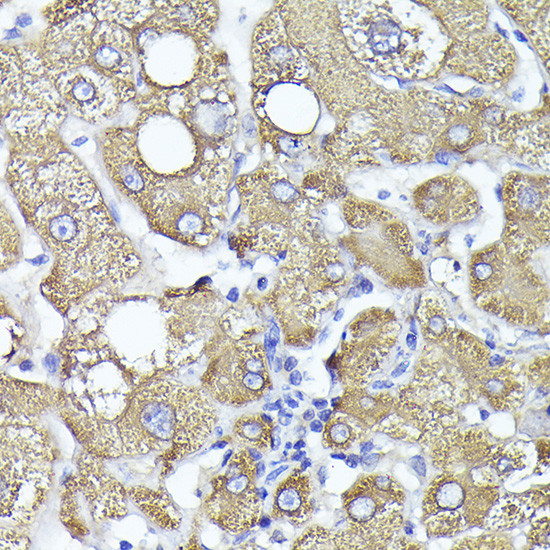 PYGL Antibody in Immunohistochemistry (Paraffin) (IHC (P))