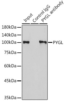 PYGL Antibody in Immunoprecipitation (IP)