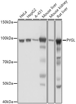 PYGL Antibody in Western Blot (WB)