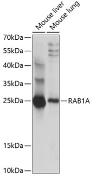 RAB1A Antibody in Western Blot (WB)