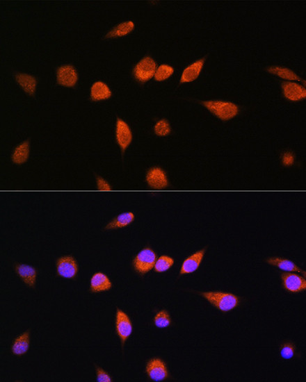 RAB20 Antibody in Immunocytochemistry (ICC/IF)