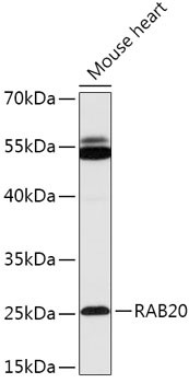 RAB20 Antibody in Western Blot (WB)