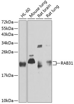 RAB31 Antibody in Western Blot (WB)