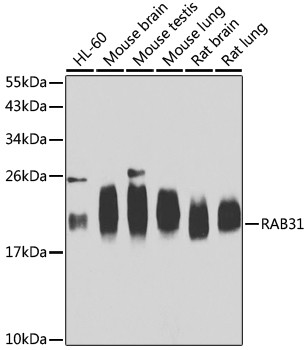 RAB31 Antibody in Western Blot (WB)