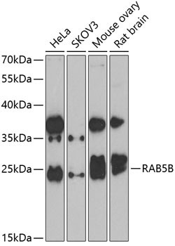 RAB5B Antibody in Western Blot (WB)