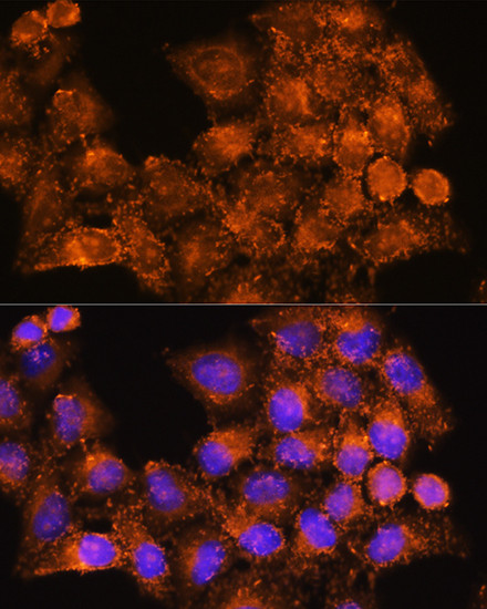 RAB7B Antibody in Immunocytochemistry (ICC/IF)