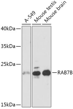 RAB7B Antibody in Western Blot (WB)