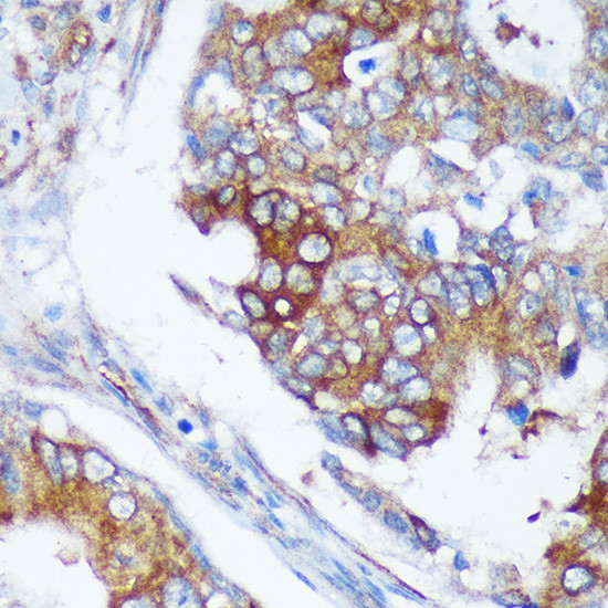 RABGAP1 Antibody in Immunohistochemistry (Paraffin) (IHC (P))