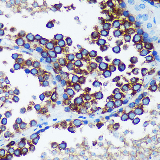 RABGAP1 Antibody in Immunohistochemistry (Paraffin) (IHC (P))