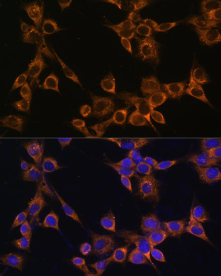 RAMP1 Antibody in Immunocytochemistry (ICC/IF)