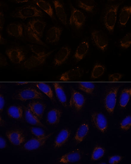 RAMP1 Antibody in Immunocytochemistry (ICC/IF)