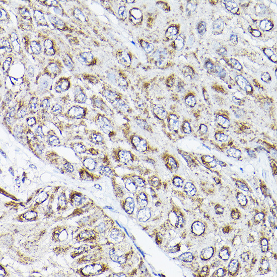 RAMP2 Antibody in Immunohistochemistry (Paraffin) (IHC (P))