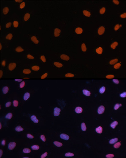 Rb Antibody in Immunocytochemistry (ICC/IF)