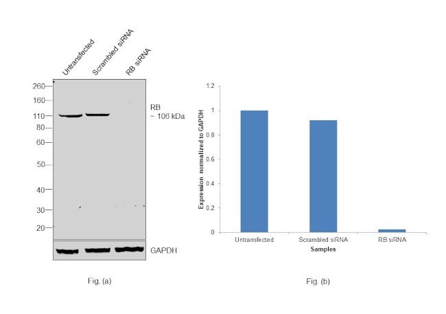 Rb Antibody