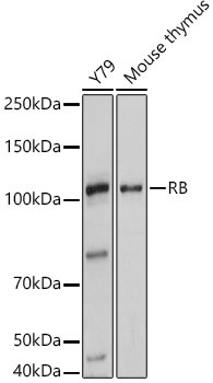 Rb Antibody in Western Blot (WB)