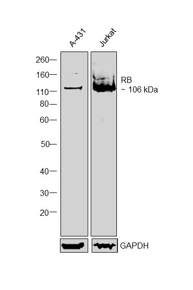 Rb Antibody in Western Blot (WB)