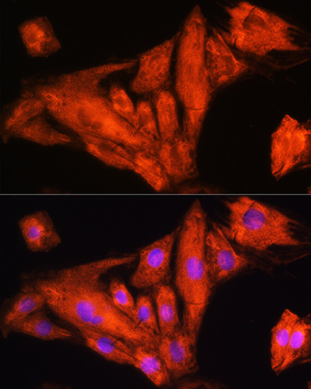 RIG-I Antibody in Immunocytochemistry (ICC/IF)