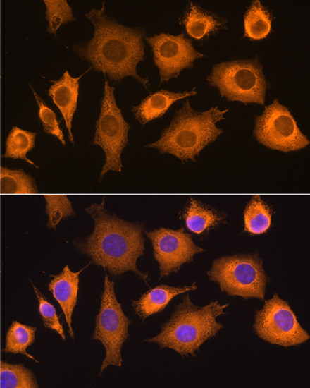 RIG-I Antibody in Immunocytochemistry (ICC/IF)