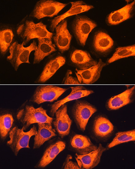 RIG-I Antibody in Immunocytochemistry (ICC/IF)