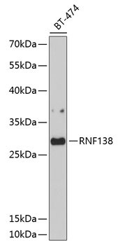 RNF138 Antibody in Western Blot (WB)